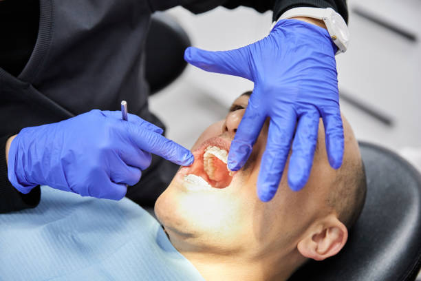 Best Emergency Dental Care for Broken or Chipped Teeth in Timberlane, IL